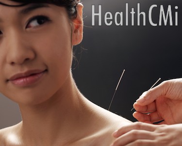 Acupuncture applied to the back reduces pain according to a new study. 