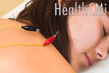 Electroacupuncture was found to successfully stop pain, numbness and weakness due to disc damage. 