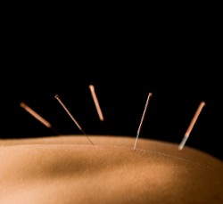 The turtle acupuncture technique often helps. 