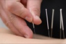 Acupuncture CEUs