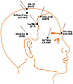 Acupuncture CEUs & Depression