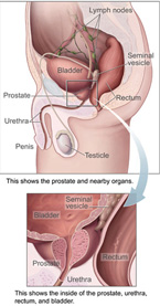 Prostatitis és prosztata méretek