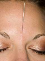 Acupuncture CEU Online Education. 