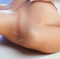Acupuncture CEUs Online. 