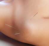 Acupuncture CEUs for NCCAOM