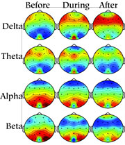 acupuncturest36theta