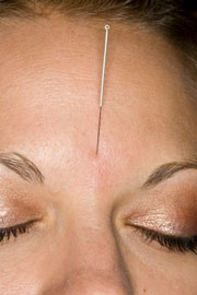 Acupuncture treats HPB. 