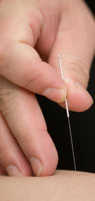 Acupuncture is shown here. 