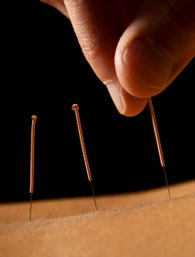 Acupuncture has point specific medical actions. 