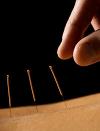 Lower back acupuncture for lumbar disc herniations relieves pain. 