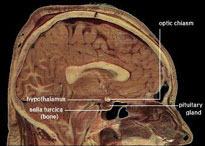 The human hypothalamus is involved in acupuncture pain reduction. 