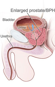 acupuncture treatment for prostate