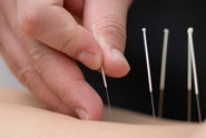 acupuncturelegal