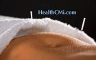 colitisceusonlineacupuncture71824