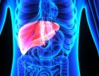 liver-cirrhosis