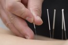 safety_in_acupuncture_2_1y