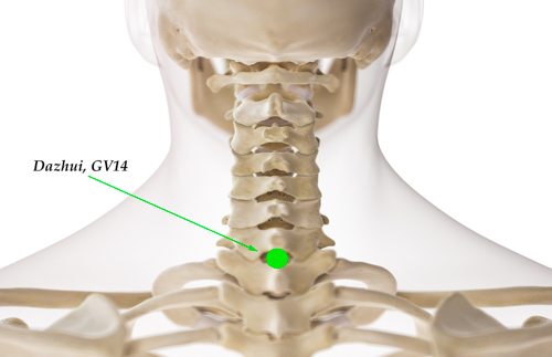Acupuncture for COVID-19 and Long COVID