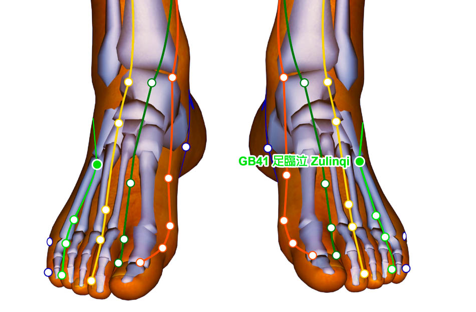 acupuncture g b41 DSPN