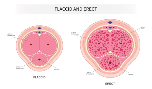Erectile Dysfunction