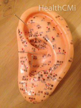 Auricular points in ear.