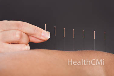 Safety in Acupuncture