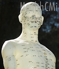 Acupoint selections.