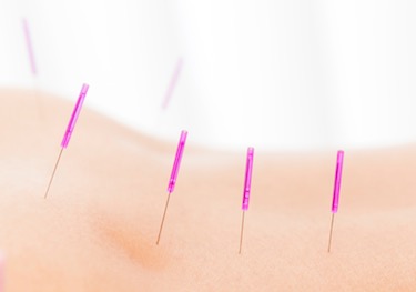 Acupoints of the lower back. 