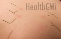 These are points on the back at UB13, UB15 and UB18.