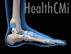 Heel pain is often treated with Kidney Channel and Ashi points.