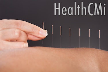 This photo shows acupuncture being applied with filiform needles to the back.