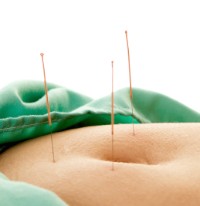 Acupoints are shown in this photo applied to the navel region.