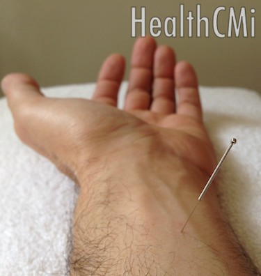 Acupoint PC6 lowers hypertension according to this new study.