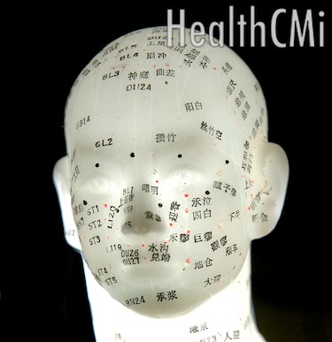 Tinnitus is ringing in the ears. 