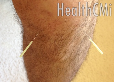 Xiyan is depicted, which includes ST35. 